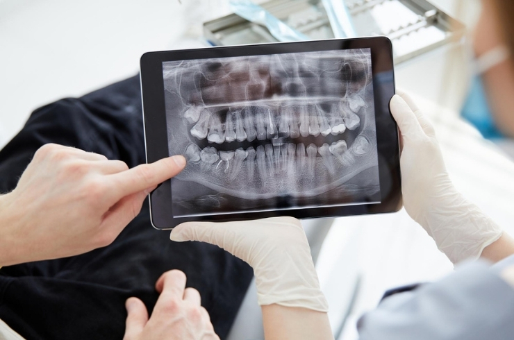 Advance-dental-technacology.jpg