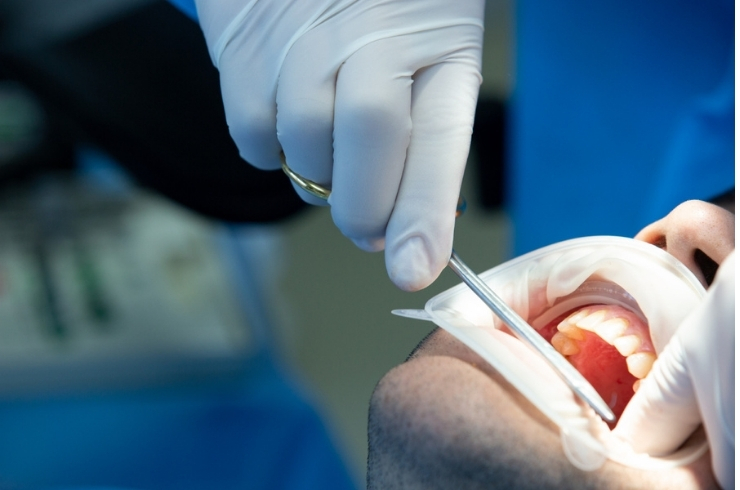 oral-surgery.jpg